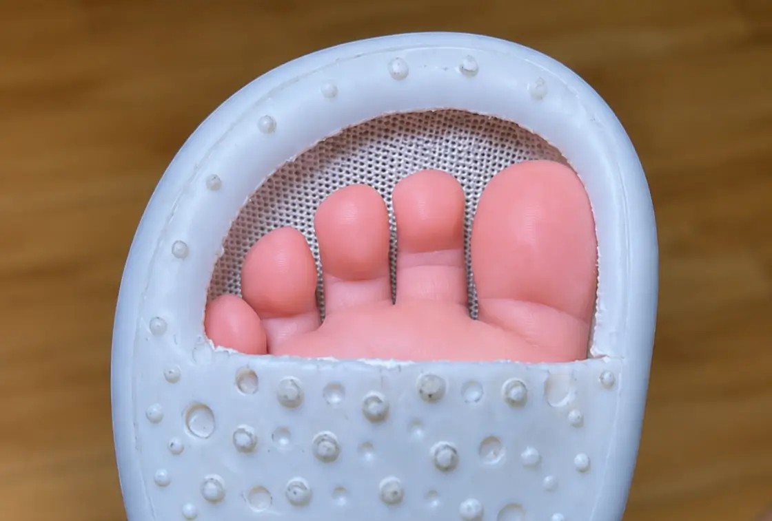Après : les orteils libres dans une chaussure Petit Gardien